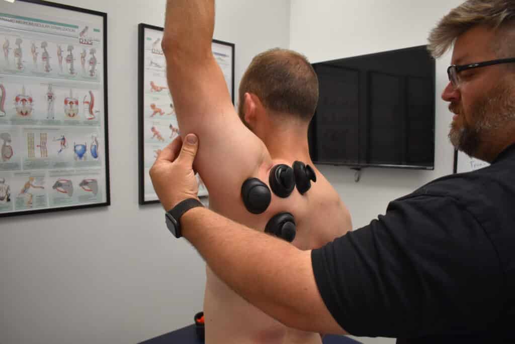 cupping therapy with movement